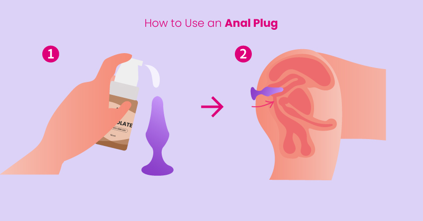 Anal Plug