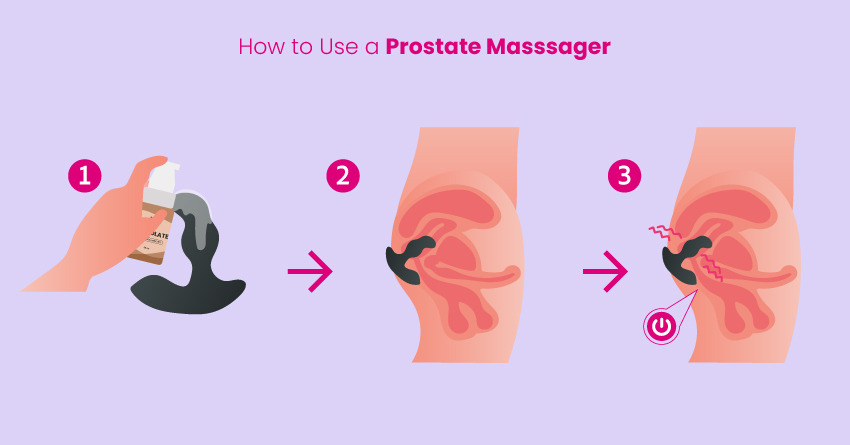 Prostate Massager