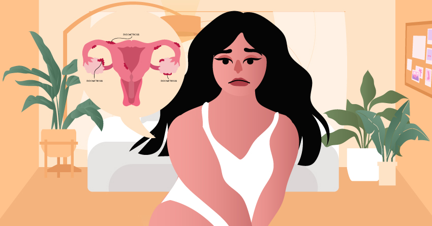 Defining Endometriosis and How It Affects Your Sex Life 