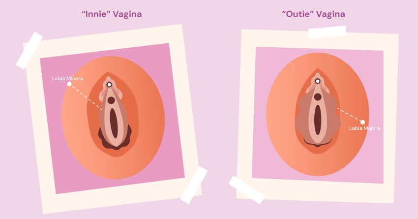 Innie vs. Outie Vagina: Does The Look of Your Vulva Matter?